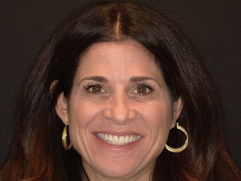 Smiling female patient with blonde hair at Vaccaro Aesthetic and Family Dentistry, Cosmetic Dentistry in Green Village, NJ