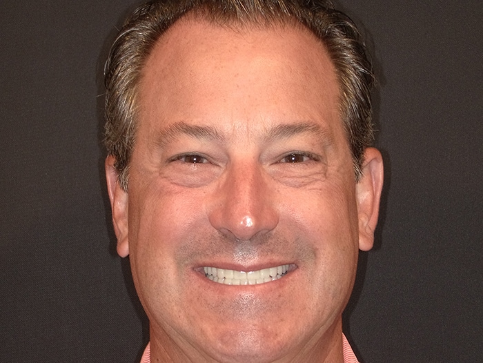 Smiling adult male patient at Vaccaro Aesthetic and Family Dentistry, Cosmetic Dentistry in Green Village, NJ