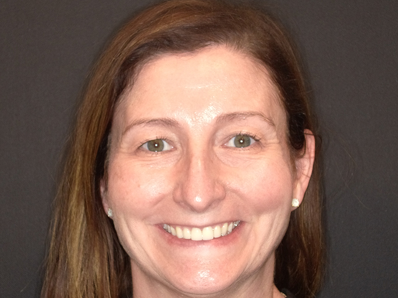 Female patient smile after cosmetic treatment photographed at Vaccaro Aesthetic and Family Dentistry in Green Village, NJ.