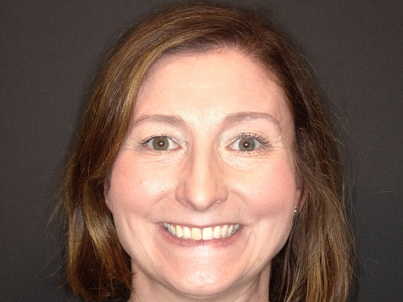 Female smiling with post-care result photographed at Vaccaro Aesthetic and Family Dentistry in Green Village, NJ.