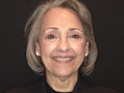 Close-up of patient teeth before or after reconstructive dentistry at Vaccaro Aesthetic and Family Dentistry in Green Village, NJ.