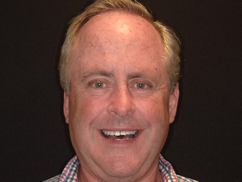 Portrait of middle-aged male patient smiling at Vaccaro Aesthetic and Family Dentistry, Cosmetic Dentistry in Green Village, NJ