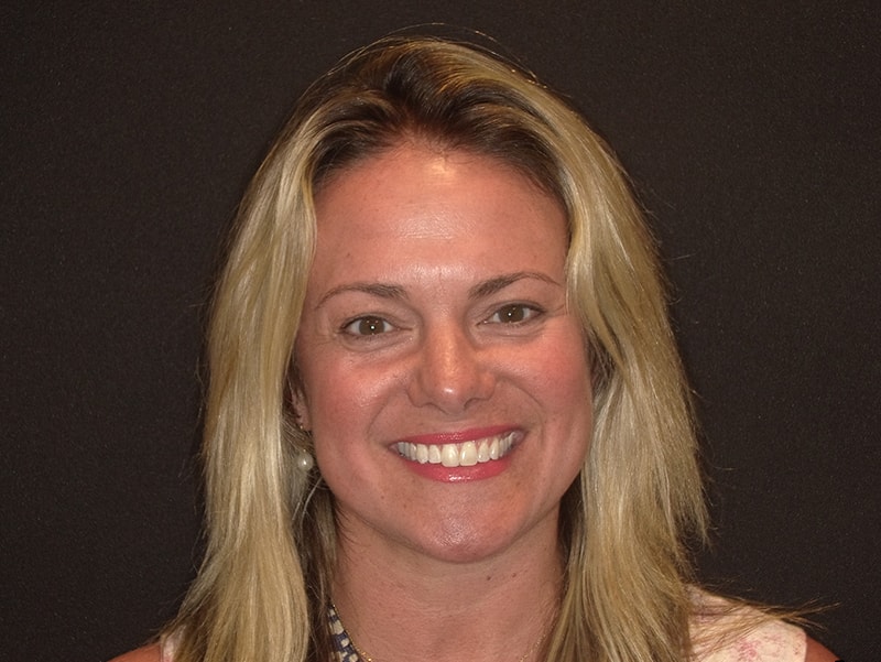 Smiling female patient with blonde hair at Vaccaro Aesthetic and Family Dentistry, Cosmetic Dentistry in Green Village, NJ