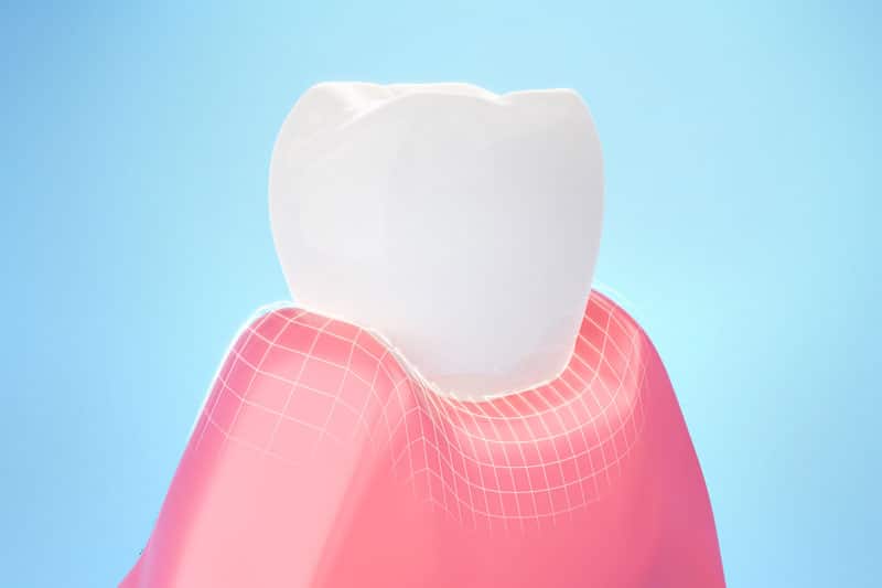 3d model of tooth Vaccaeo Aesthetic
